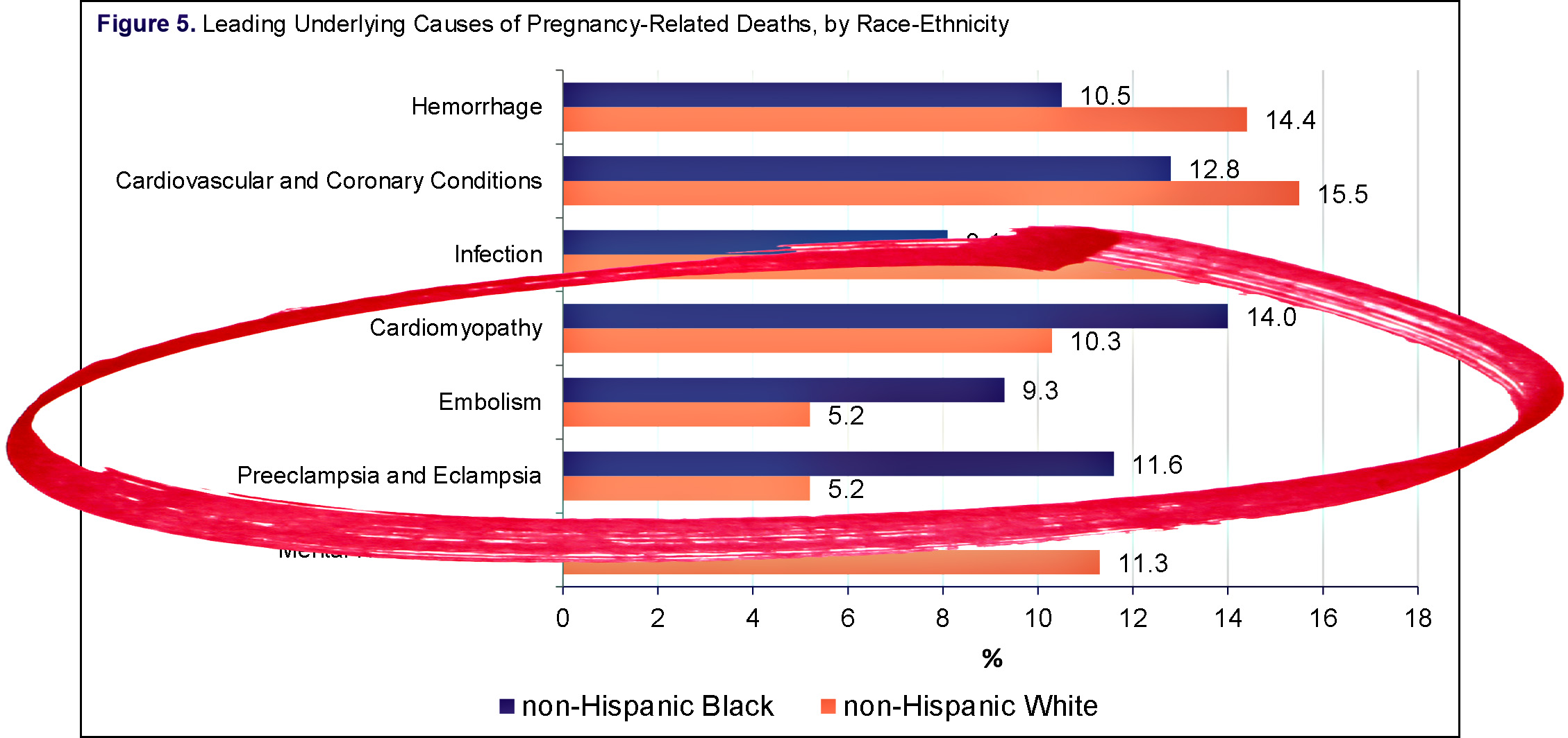 how-can-we-reduce-black-maternal-mortality-mother-jones