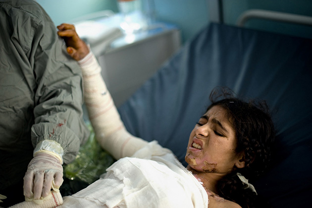 Afghanistan’s Burned Brides Mother Jones