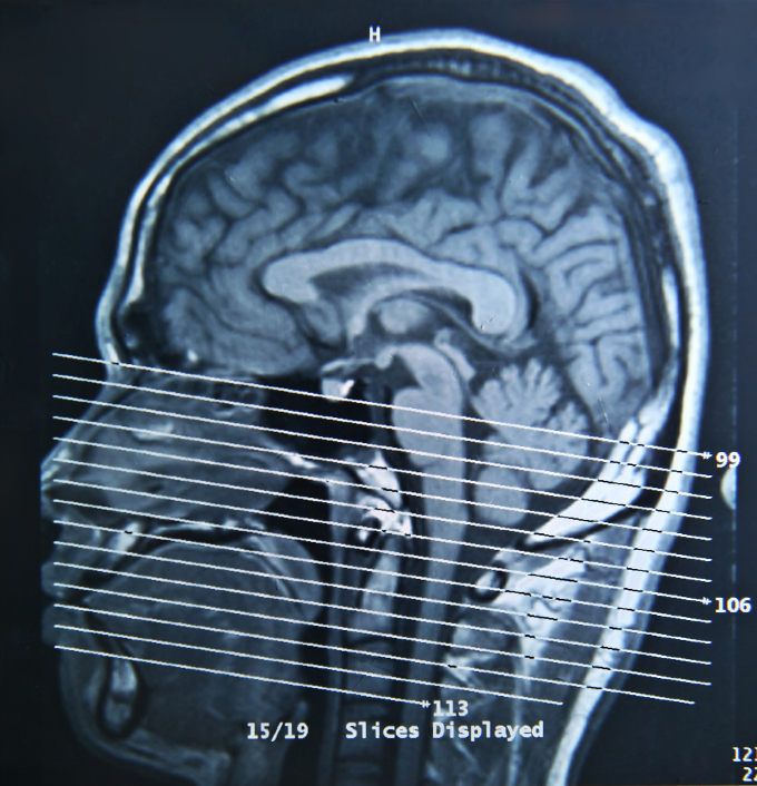Head to toe: Study reveals brain activity behind missed penalty kicks