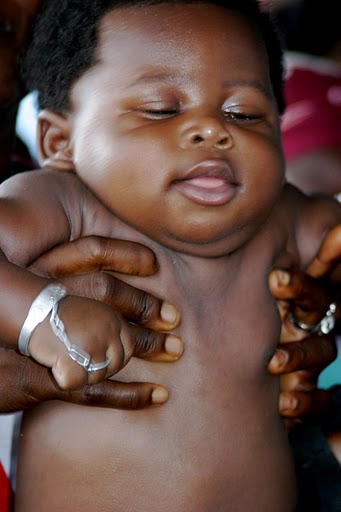 Liberian baby held up by mom on baby weighing day at a local health clinic in Monrovia