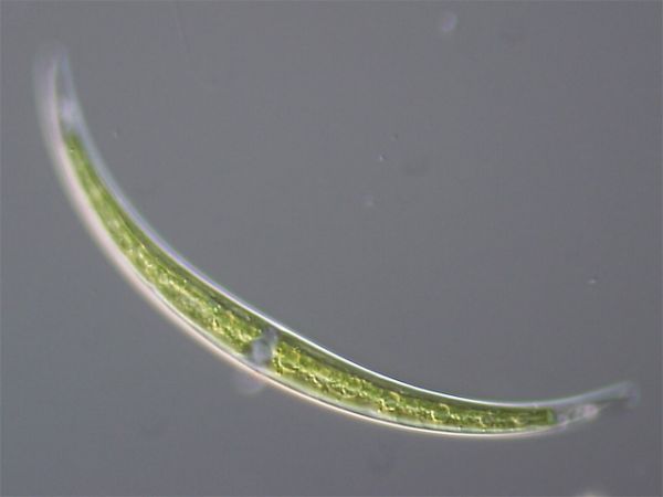 An alga from the genus Closterium. Credit: 	  ja:User:NEON / User:NEON_ja, via Wikimedia Commons.