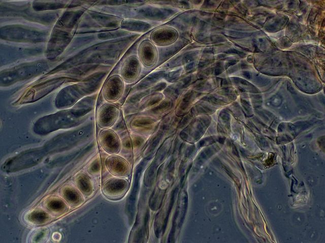 The unreleased spores of a morel mushroom {Morchella elata} magnified 40 times. Photo by Peter G. Werner, courtesy Wikimedia Commons.