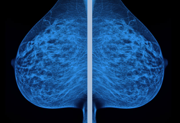 Breast Cancer Now on X: There's no right or wrong way to check